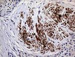 TGM2 Antibody in Immunohistochemistry (Paraffin) (IHC (P))