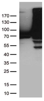 TGM2 Antibody in Western Blot (WB)