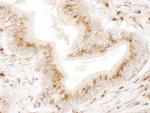 TGOLN2 Antibody in Immunohistochemistry (IHC)