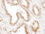 TGOLN2 Antibody in Immunohistochemistry (IHC)