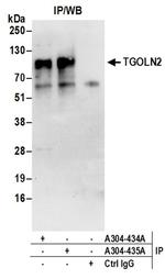 TGOLN2 Antibody in Western Blot (WB)