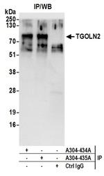 TGOLN2 Antibody in Western Blot (WB)