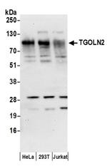 TGOLN2 Antibody in Western Blot (WB)