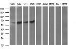 TH Antibody in Western Blot (WB)