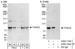 THOC5 Antibody in Western Blot (WB)