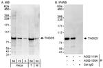 THOC5 Antibody in Western Blot (WB)