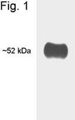 THRA/THRB Antibody in Western Blot (WB)