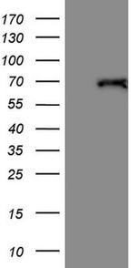 THRA Antibody in Western Blot (WB)