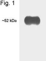 THRB Antibody in Western Blot (WB)