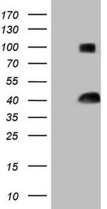 THTPA Antibody in Western Blot (WB)