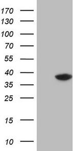 THTPA Antibody in Western Blot (WB)