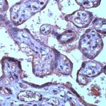 TIMP3 Antibody in Immunohistochemistry (Paraffin) (IHC (P))