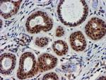 TIMP2 Antibody in Immunohistochemistry (Paraffin) (IHC (P))