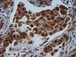 TIMP2 Antibody in Immunohistochemistry (Paraffin) (IHC (P))