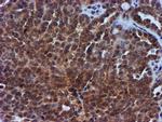 TIMP2 Antibody in Immunohistochemistry (Paraffin) (IHC (P))