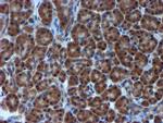 TIMP2 Antibody in Immunohistochemistry (Paraffin) (IHC (P))