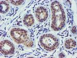 TIMP2 Antibody in Immunohistochemistry (Paraffin) (IHC (P))