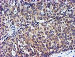 TIMP2 Antibody in Immunohistochemistry (Paraffin) (IHC (P))