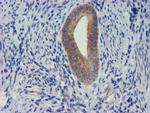 TIMP2 Antibody in Immunohistochemistry (Paraffin) (IHC (P))