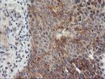 TIMP2 Antibody in Immunohistochemistry (Paraffin) (IHC (P))