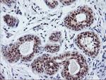 TIMP2 Antibody in Immunohistochemistry (Paraffin) (IHC (P))