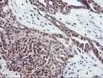 TIMP2 Antibody in Immunohistochemistry (Paraffin) (IHC (P))