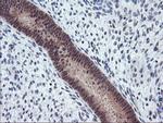 TIMP2 Antibody in Immunohistochemistry (Paraffin) (IHC (P))