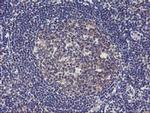 TIMP2 Antibody in Immunohistochemistry (Paraffin) (IHC (P))