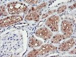 TIMP2 Antibody in Immunohistochemistry (Paraffin) (IHC (P))