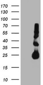 TIMP2 Antibody in Western Blot (WB)