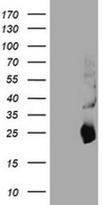 TIMP2 Antibody in Western Blot (WB)