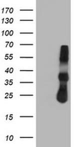 TIMP2 Antibody in Western Blot (WB)