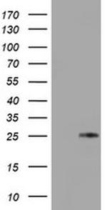 TIMP2 Antibody in Western Blot (WB)