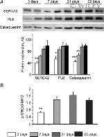 Calsequestrin Antibody in Western Blot (WB)