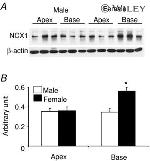 Sodium/Calcium Exchanger Antibody in Western Blot (WB)