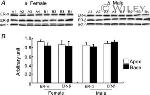 Estrogen Receptor alpha Antibody in Western Blot (WB)