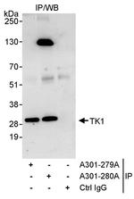 TK1 Antibody in Immunoprecipitation (IP)