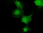 TKT Antibody in Immunocytochemistry (ICC/IF)