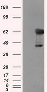 TKT Antibody in Western Blot (WB)