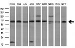 TKT Antibody in Western Blot (WB)