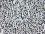 TLE1 Antibody in Immunohistochemistry (Paraffin) (IHC (P))