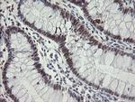 TLE1 Antibody in Immunohistochemistry (Paraffin) (IHC (P))