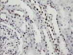 TLE1 Antibody in Immunohistochemistry (Paraffin) (IHC (P))