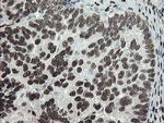 TLE1 Antibody in Immunohistochemistry (Paraffin) (IHC (P))