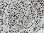 TLE1 Antibody in Immunohistochemistry (Paraffin) (IHC (P))