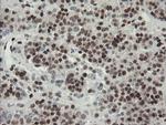 TLE1 Antibody in Immunohistochemistry (Paraffin) (IHC (P))