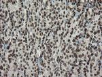 TLE1 Antibody in Immunohistochemistry (Paraffin) (IHC (P))