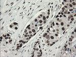 TLE1 Antibody in Immunohistochemistry (Paraffin) (IHC (P))