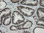 TLE1 Antibody in Immunohistochemistry (Paraffin) (IHC (P))