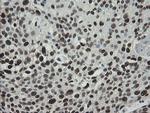 TLE1 Antibody in Immunohistochemistry (Paraffin) (IHC (P))